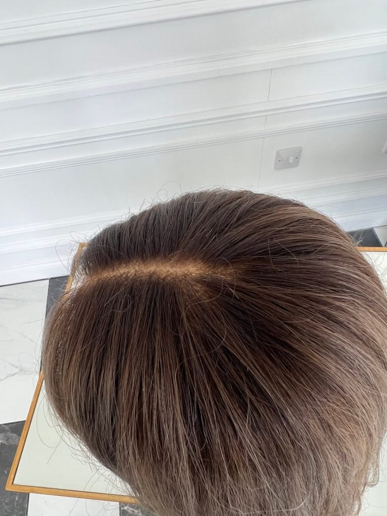 FIONA (LACE FRONT)
